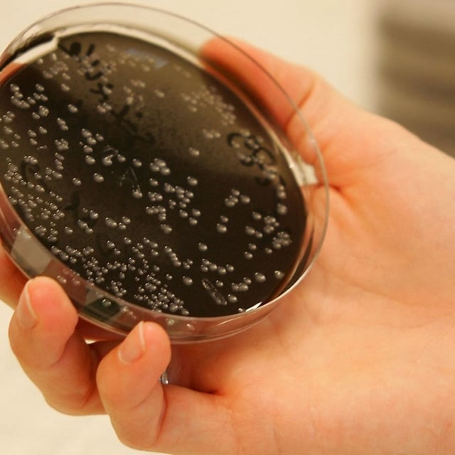 Une technicienne de laboratoire présente des particules de légionelle. (Photo d'illustration)