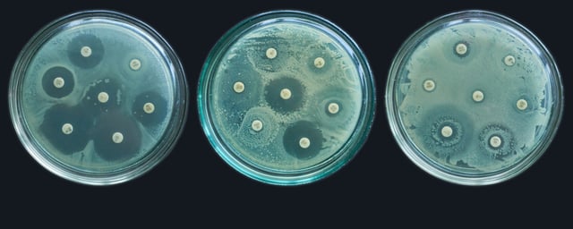 kirby bauer method. Antibiotic Sensitivity Test. Methods in Detecting Antimicrobial Resistance using petri dish. multidrug resistance