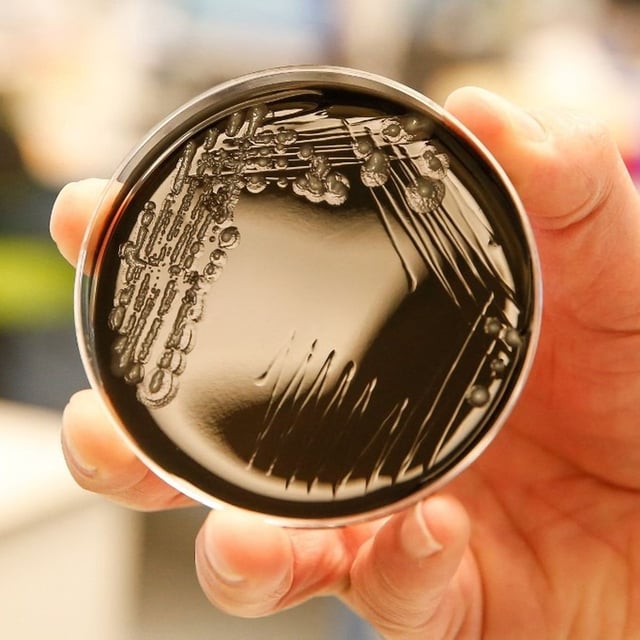 Une culture de la bactérie Legionella pneumophila (photo d'illustration).