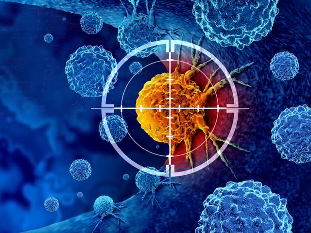 Nach einem Bericht des Fachmagazins "The Lancet" wird die Zahl der Krebsfälle bis 2050 weltweit auf 30,5 Millionen steigen.