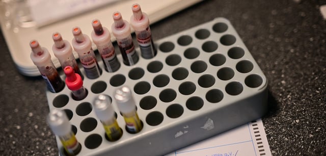 Ampullen mit Blut für einen Test auf HIV und andere Geschlechtskrankheiten
