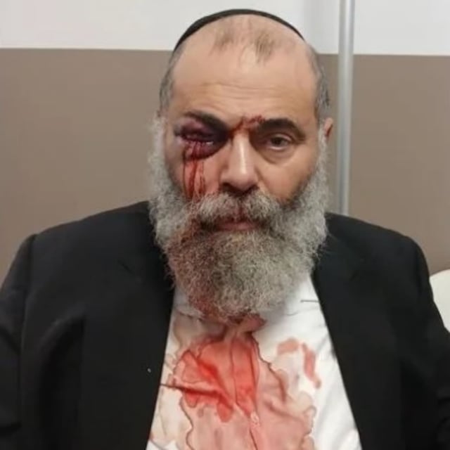 Gilles Cohen, agressé samedi matin, à Yerres.