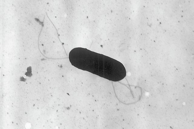 This 2002 electron microscope image made available by the Centers for Disease Control and Prevention shows a Listeria monocytogenes bacterium. Health officials are linking a listeria outbreak to pasta meal products sold at Walmart and Trader Joe's.