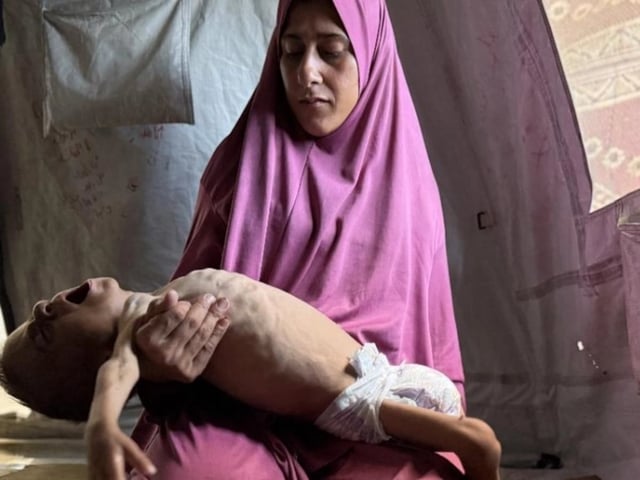 La imagen de la agonía por desnutrición de Mohamed ante la impotencia de su madre en Gaza dio la vuelta al mundo