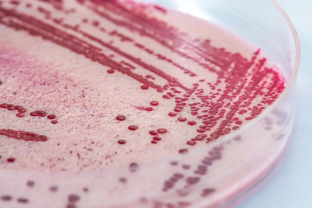 Four deaths have been traced to listeria in prepared pasta meals. (Dreamstime/Dreamstime/TNS)