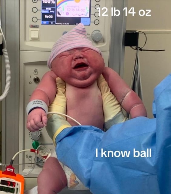 Baby Cassian, soon after being born.