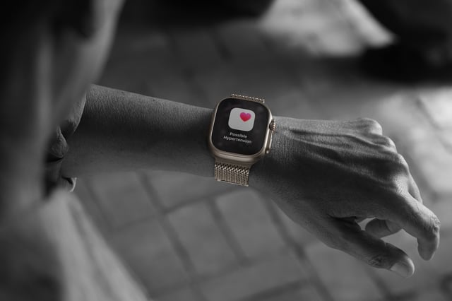 Hypertension Detection is not exclusive to the Apple Watch Ultra 3.