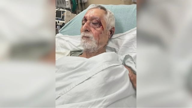 Florentino Hurtado was attacked in the parking lot of a meat market in Houston, Texas, according to his family.