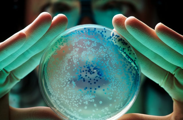 A researcher holds a petri dish with growing bacteria