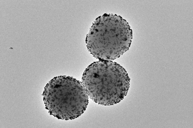 Transmission electron microscopy image of the nanorobots. (credit: IBEC Barcelona)