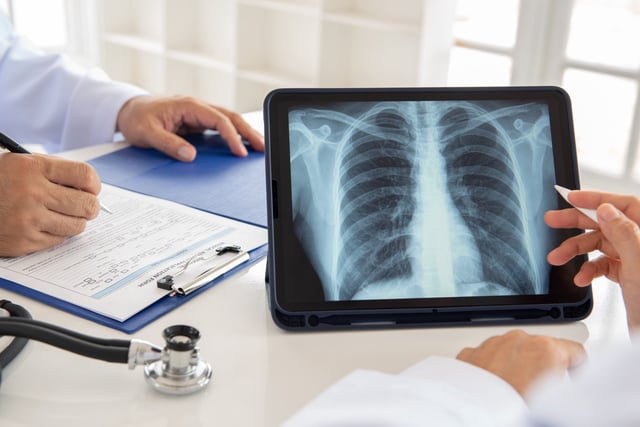 Lung cancer screening