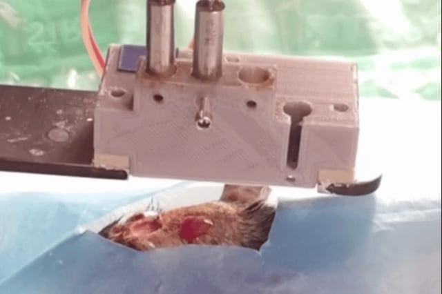 Full-thickness living skin was 3D printed to precisely correct a significant skin injury during surgery