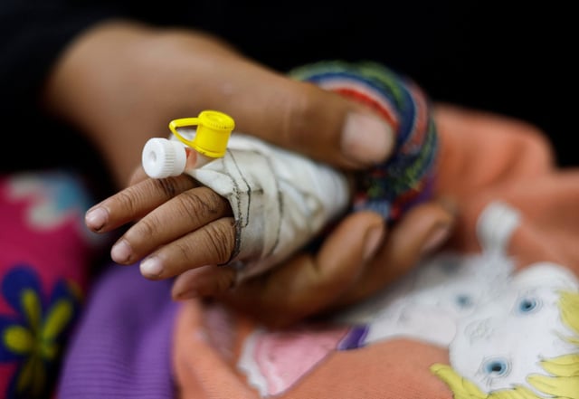 A Palestinian child suffering from malnutrition receives treatment at a healthcare center in Rafah, in southern Gaza, on March 4. Children and mothers are among those most at risk of severe malnutrition.