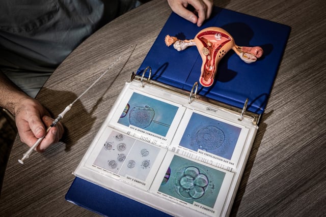 A model of the female reproductive system and an embryo transfer catheter in a doctor office on Feb. 29, 2024, in Fountain Valley, Calif.
