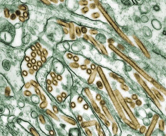 Digitally-colorized transmission electron microscopic image of Avian Influenza A H5N1 virus particles (seen in gold), grown in Madin-Darby Canine Kidney (MDCK) epithelial cells (seen in green).