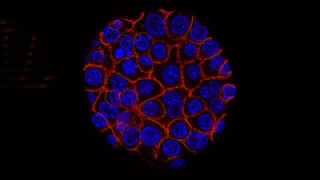 This image from the National Cancer Institute shows pancreatic cancer cells (blue) growing as a sphere encased in membranes (red).