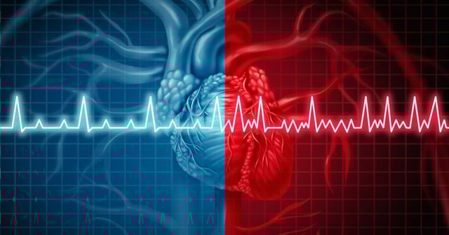 An AI model predicts atrial fibrillation (AF) 30 minutes in advance