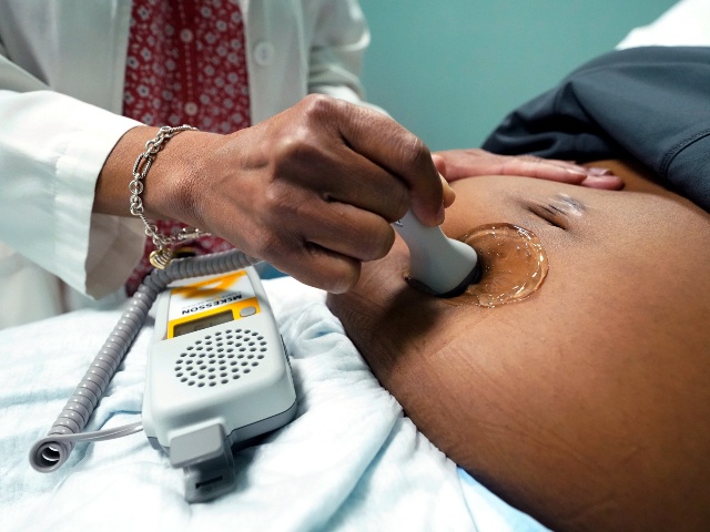 FILE - A doctor uses a hand-held Doppler probe on a pregnant woman to measure the heartbeat of the fetus on Dec. 17, 2021, in Jackson, Miss. As the first bills trickle in for Louisiana's upcoming legislative session, among them is proposed legislation that would allow mothers to “recover” 50% of out-of-pocket pregnancy-related medical expenses from the father of their child. (AP Photo/Rogelio V. Solis, File)
