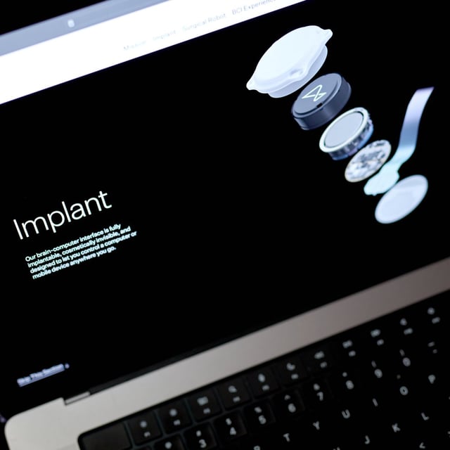 Neuralink's first implant in a human brain experienced data loss likely due to an issue during surgery.