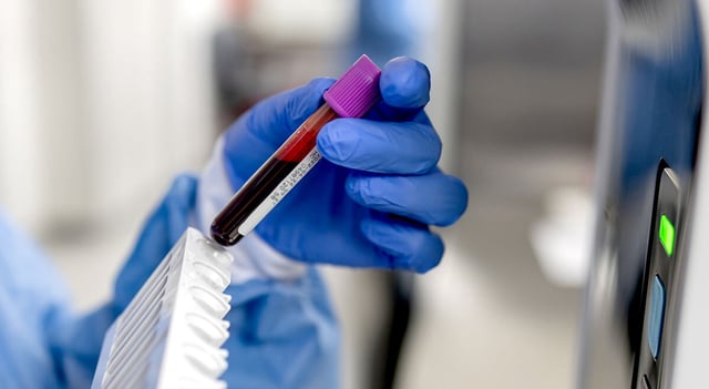 Close-up on a technician analyzing blood samples at the lab and holding a test tube. (Credit: The Rockefeller University)