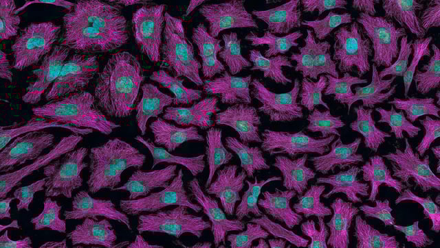 What Will The Global Disease Landscape Look Like In 2050?