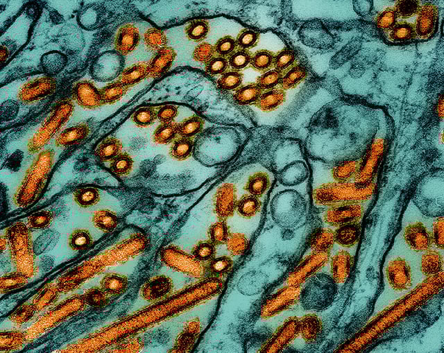 Avian Influenza A Virus (H5N1/Bird Flu) Colorized transmission electron micrograph of avian influenza A H5N1 virus particles (orange), grown in Madin-Darby Canine Kidney (MDCK) epithelial cells (green). Microscopy by CDC; repositioned and recolored by NIAID. Credit: CDC and NIAID