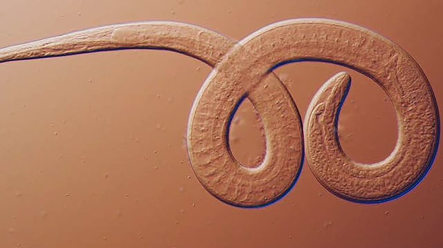 from black bear meat suspected as the source of an outbreak of human Trichinella nativa infections — Arizona, Minnesota, and South Dakota, 2022