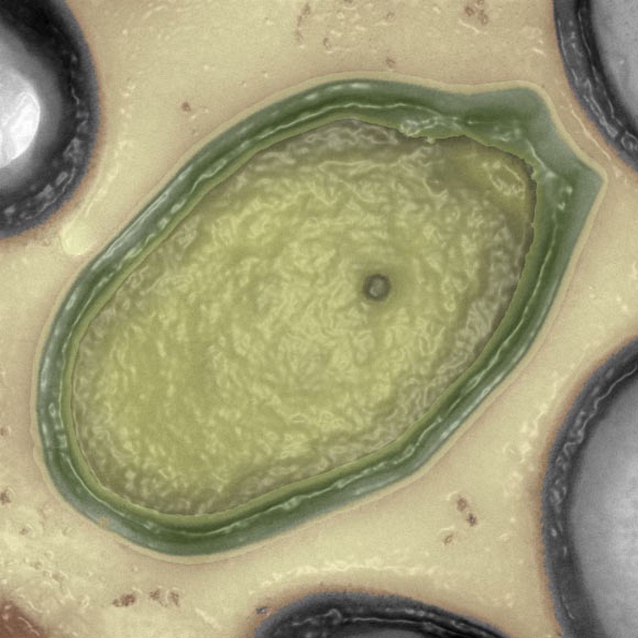 Pandoravirus salinus (© IGS CNRS-AMU)