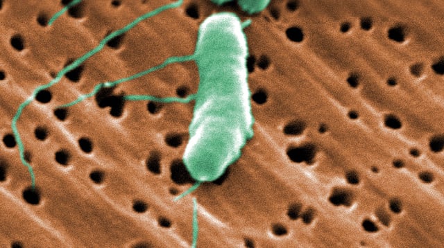 Vibrio Vulnificus Bacterium