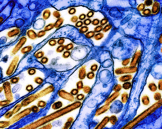Colorized transmission electron micrograph of avian influenza A H5N1 virus particles (yellow/red), grown in Madin-Darby Canine Kidney (MDCK) epithelial cells. Microscopy by CDC; repositioned and recolored by NIAID. Credit: CDC and NIAID