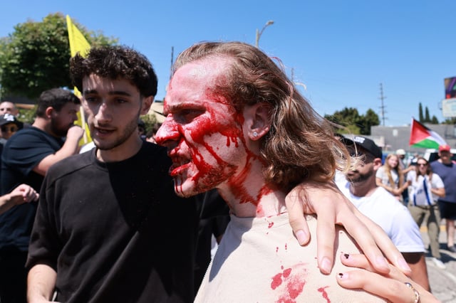 A supporter of Israel with blood on his face, is helped up after clashing with pro-Palestinian protesters blocking access to the Adas Torah Orthodox Jewish synagogue, in Los Angeles, June 23, 2024.