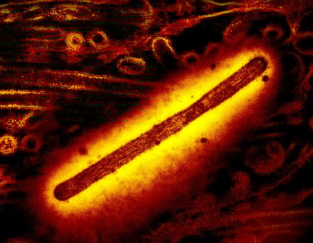 Influenza A Virus (H5N1/Bird Flu) Transmission electron microscope image of a rod-shaped influenza A H5N1/bird flu virion; in the background is a second transmission electron micrograph of H5N1 virus particles (both round and rod-shaped). Creative composition and colorization/effects by NIAID; transmission electron micrograph imagery is courtesy CDC. Scale has been modified/not to scale. Credit: CDC and NIAID Colorized in Halloween-appropriate colors. Stay safe this Halloween!