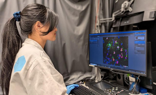 Scientist captures images of human oligodendrocytes in a dish (stained green), which produce the protein implicated in causing Alzheimer's disease. Image Credit: Francesca Lam
