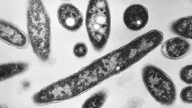 FILE - This 1978 electron microscope image made available by the Centers for Disease Control and Prevention shows Legionella pneumophila bacteria which are responsible for causing the pneumonic disease Legionnaires' disease. Poland's internal security officers were searching for the source of a deadly outbreak of Legionnaires' disease which has killed seven people and infected more than 100 others in the strategic city of Rzeszow, near the border with Ukraine, authorities said Friday Aug. 25, 2023. (Francis Chandler/CDC via AP, File)
