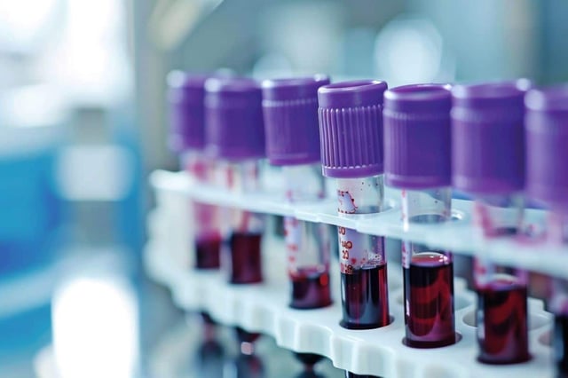 After careful statistical analyses of the results, the researchers identified one compound in cord blood that may have strong implications for ASD severity, namely 11,12- dihydroxyeicosatrienoic acids (diHETrE), a dihydroxy fatty acid derived from arachidonic acid. Credit: Neuroscience News