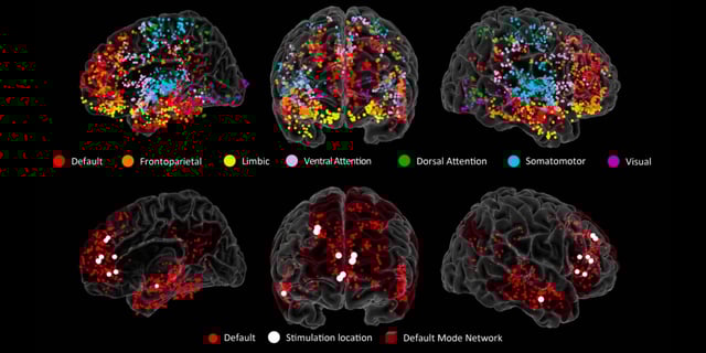 Electrodes at multiple brain regions reveal brain activity in real time. Colored dots show the locations of all of the electrodes across all patients, color-coded by brain region. Red dots in the lower images show the locations of the electrodes in the DMN. (Credit: Bartoli, et al.)