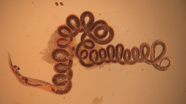 A microscope image of a tiny semi-transparent worm curled into many loops