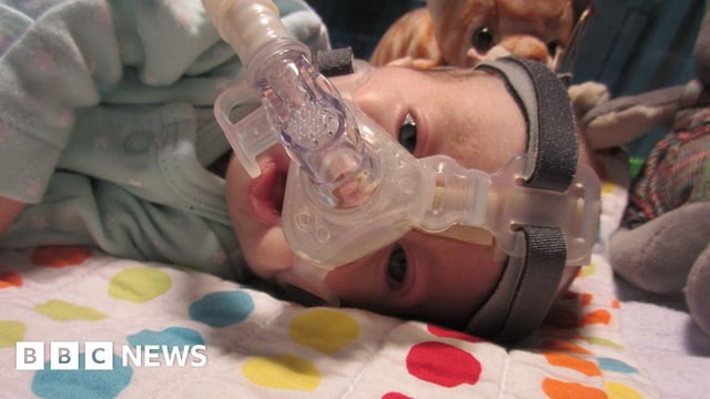 Baby Rumer is wearing a C-Pap machine to help her breathe. She is lying on a hospital cot and has teddies behind her.