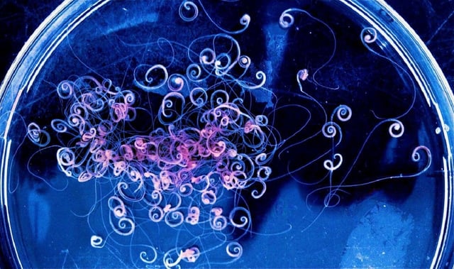Ecuadorian whipworms (Trichuris trichiuria) (image: Mark Taylor)