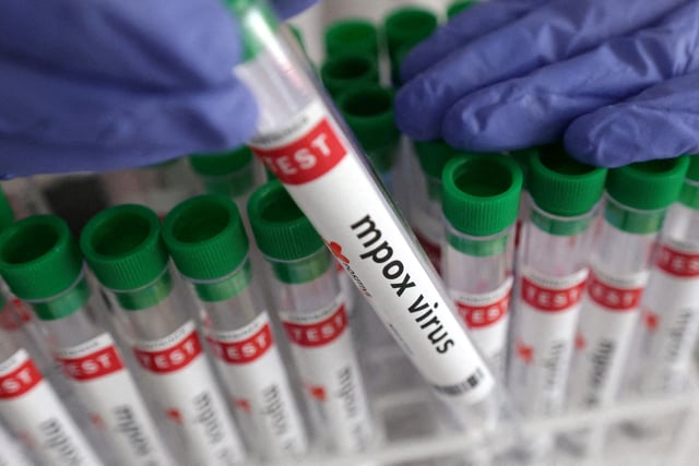A test tube labeled "mpox virus positive" is held in this illustration taken Aug. 20, 2024.