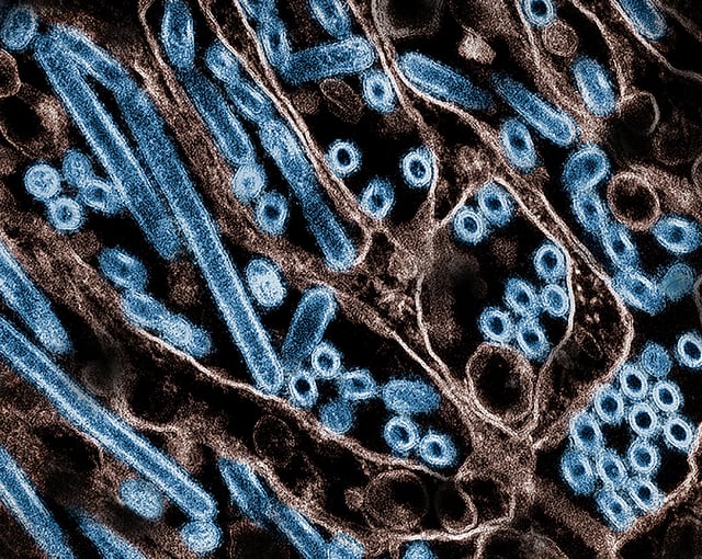 Avian Influenza A Virus (H5N1/Bird Flu) Colorized transmission electron micrograph of avian influenza A H5N1 virus particles (blue), grown in Madin-Darby Canine Kidney (MDCK) epithelial cells. Microscopy by CDC; repositioned and recolored by NIAID. Credit: CDC and NIAID https://www.flickr.com/photos/niaid/53743719654/in/photolist-2ootp5B-2ooowQi-2pYKniF-2q33J1z-2pVCjkc-2pYKXgM-2pX4Erc-2pT9Bs7-2pFzQ15-2pFtBvq-2pc6Myc-2pc78F1-2pc2iit-2pYaoxd-2pFELA2-2pXVXRU-2pc8G4U-2pc2iGz-2pc2fMM-2pc6Myx-2pVBgus-2pY3pts-2pFAorU-2pFEbVG-2q34bnP-2q33JcB-2pT8T6h-2pT3bRZ-2pX9t9g-2pJkbdu-2pFMwpW-2pY9Q5m-2pXVXKg-2pY8aVQ-2pX9uqp-2pXaA31-2pY9RFT-2pX4Eut